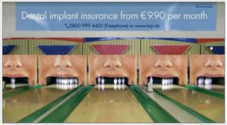 Dental implant ad